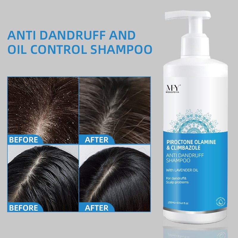 2% piroctone ethanolamine clindazole professional anti-dandruff shampoo containing aloe vera extract lavender shampoo