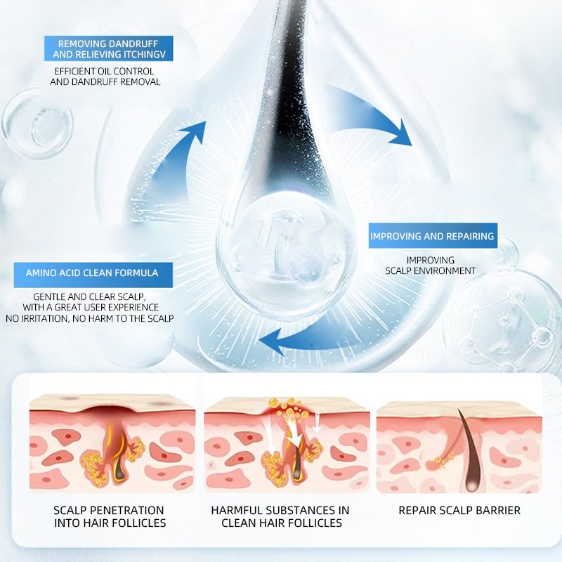 2% piroctone ethanolamine clindazole professional anti-dandruff shampoo containing aloe vera extract lavender shampoo