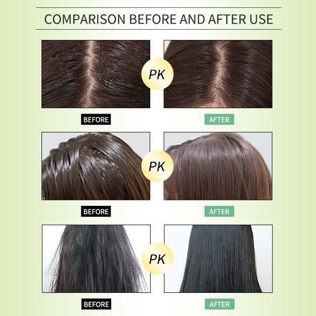 Hot Selling Original Chinese Herbal Natural Mugwort Shampoo Hair Repairing Anti-dandruff Moisturizing Shampoo Product