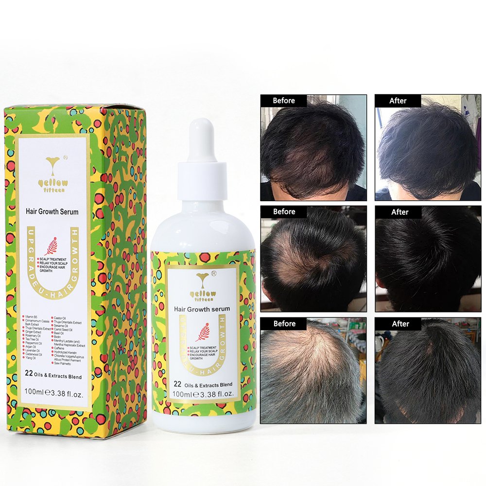 RevitalizeRoots Hair Growth Serum Unlock the Secret to Fuller, Thicker Hair Natural Blend of Potent Ingredients
