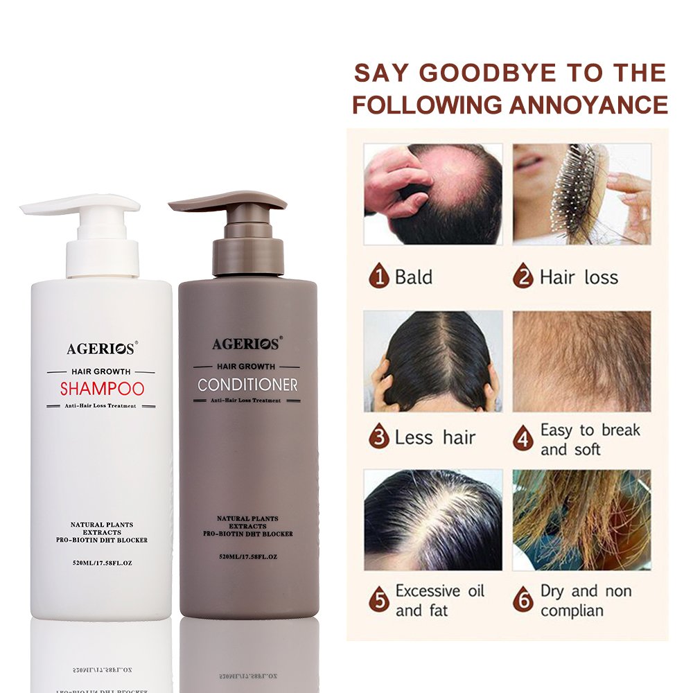 High-End Brand Agerios Silicone-Free Herbal Nature oil Control Moisturizing Hair Shampoo Cure Hair Loss