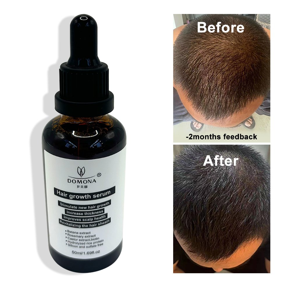 100% Organic Pure Raw Unrefined Batana Oil for hair growth shampoo bulk drum kilo 5 kg 170 oz
