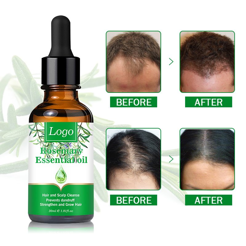 Private Label Herbal Revitalizing Hair Growth Tonic Anti Hair Loss Growth Serum Rosemary Oil for hair regrowth