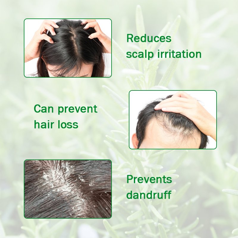 Private Label Herbal Revitalizing Hair Growth Tonic Anti Hair Loss Growth Serum Rosemary Oil for hair regrowth
