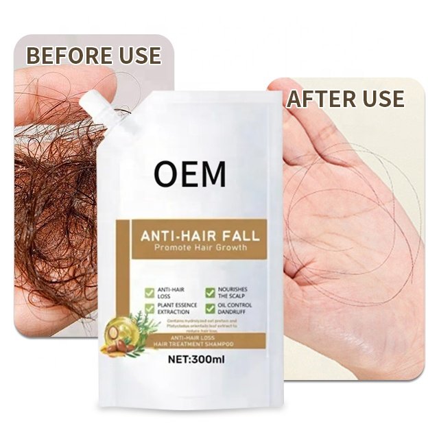 Wholesale Herbal Organic Vegan Anti Hair Fall Shampoo For Baldness Treatment Prevent Hair Loss Promote Hair Regrow Shampoo