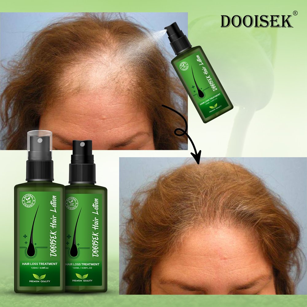 Hair loss regrowth treatments 120ml hair growth liquid scalp spray serum new bunee hair lotion thailand
