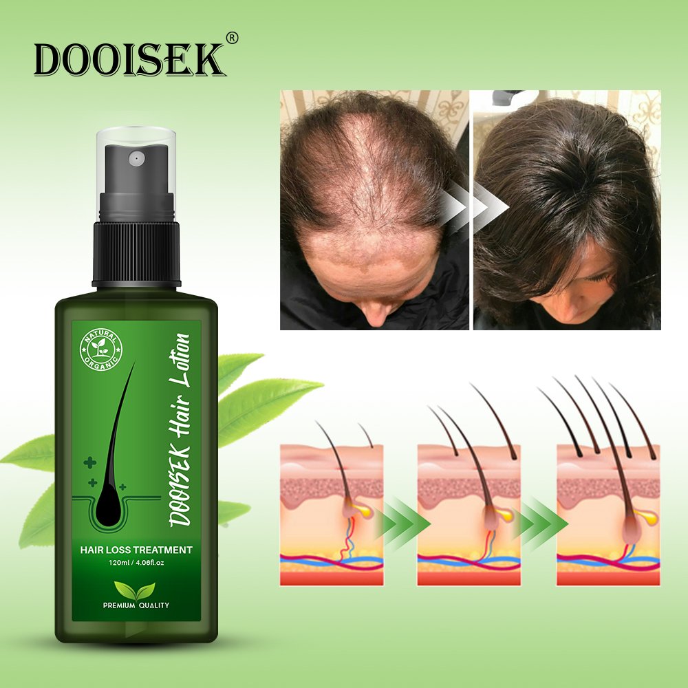 Hair loss regrowth treatments 120ml hair growth liquid scalp spray serum new bunee hair lotion thailand