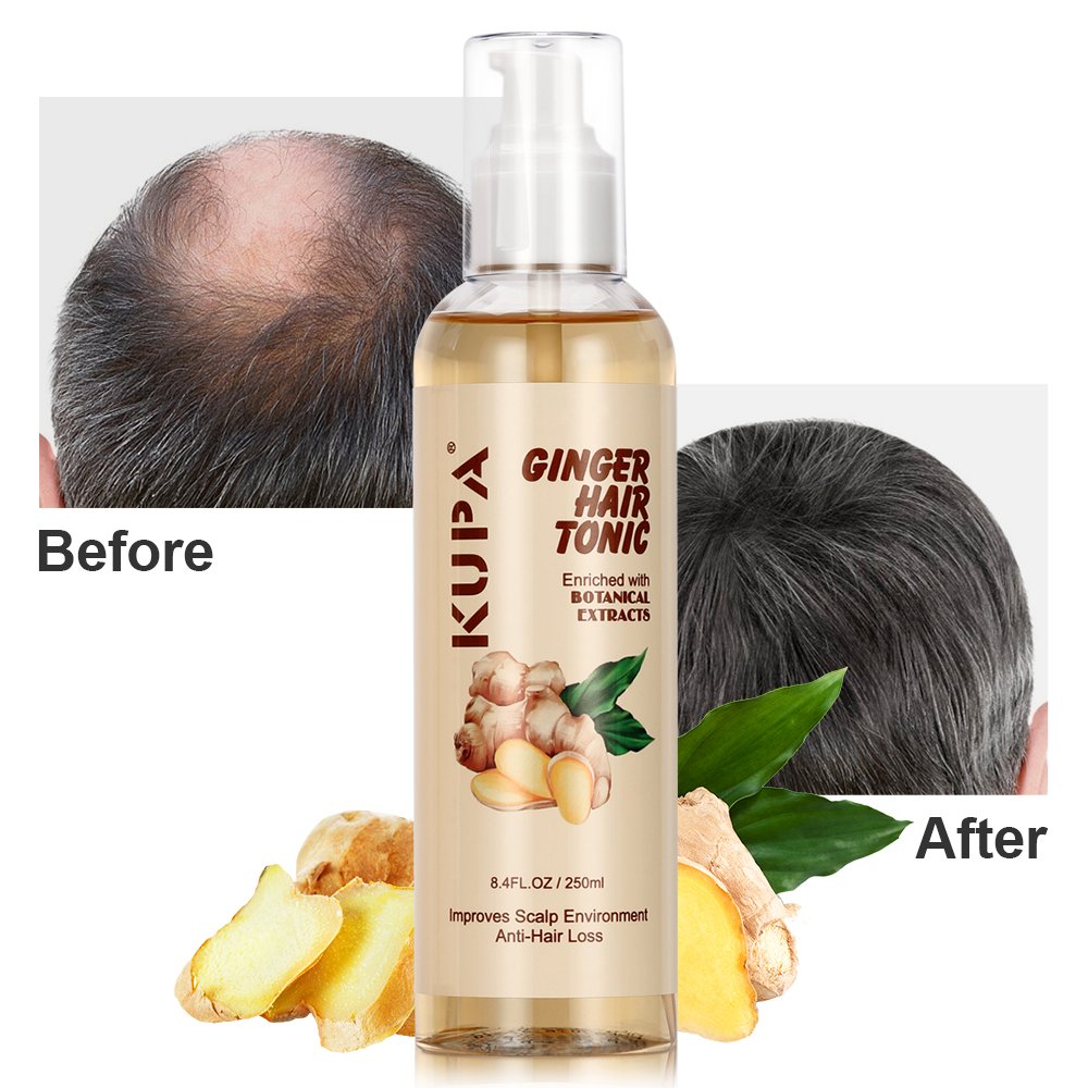 Free Samples Scalp Hair Tonic Repairing Anti Loss Regrowth Oil Natural Ginger Hair Growth Tonic
