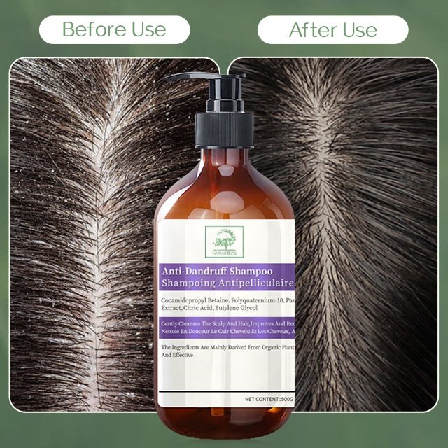 Customized High-End Brand Anti-Dandruff Shampoo Hair Care Manufacturer OEM ODM Dandruff Control Scalp Care Shampoo