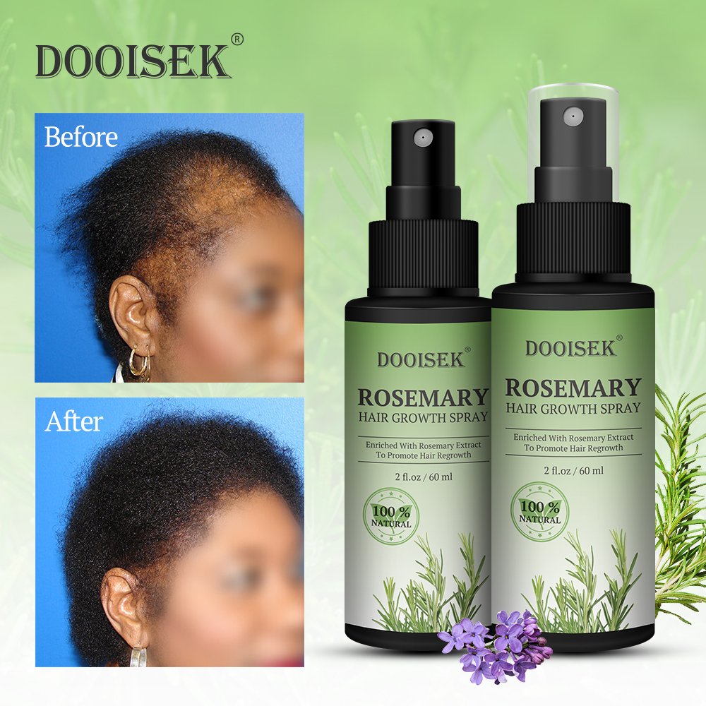 Hot sale anti hair loss treatment rosemary fast hair growth spray essential oil scalp serum biotin hair regrowth tonics for men
