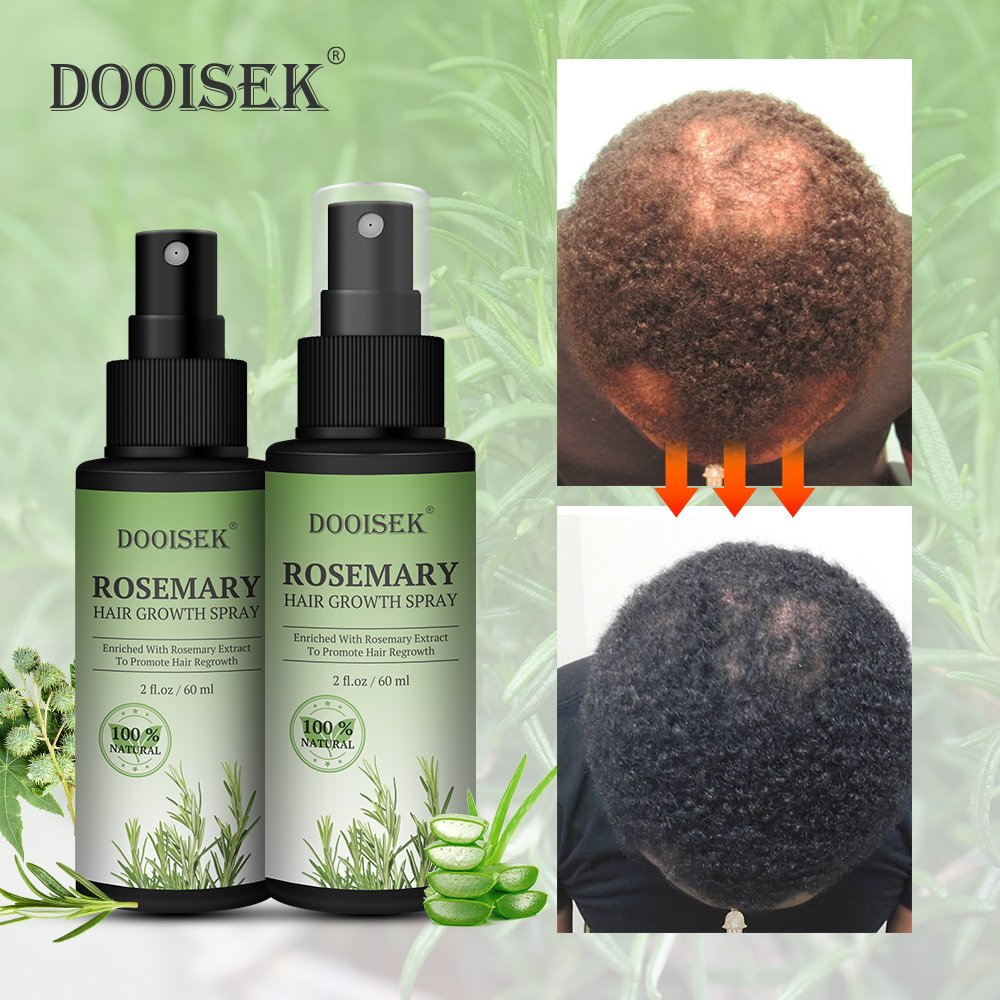 Hot sale anti hair loss treatment rosemary fast hair growth spray essential oil scalp serum biotin hair regrowth tonics for men