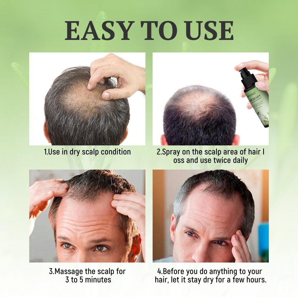 Hot sale anti hair loss treatment rosemary fast hair growth spray essential oil scalp serum biotin hair regrowth tonics for men