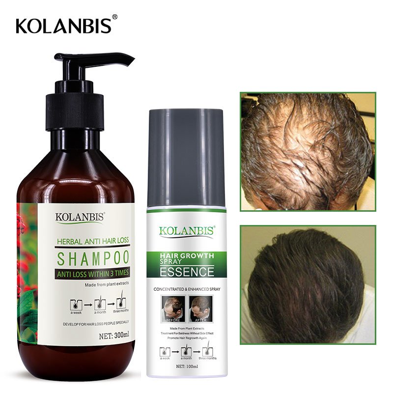Effective Hair Regrowth Tonic Bald Head Treatment With Organic Herbal Plants Extracts