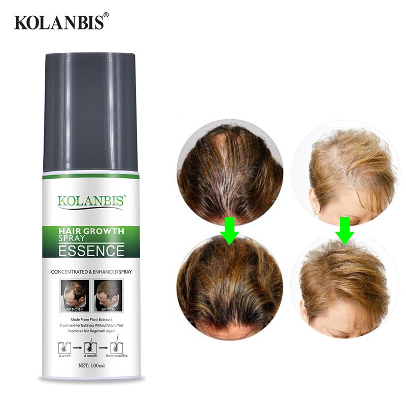 Effective Hair Regrowth Tonic Bald Head Treatment With Organic Herbal Plants Extracts