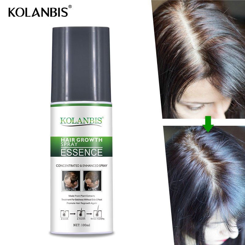Effective Hair Regrowth Tonic Bald Head Treatment With Organic Herbal Plants Extracts