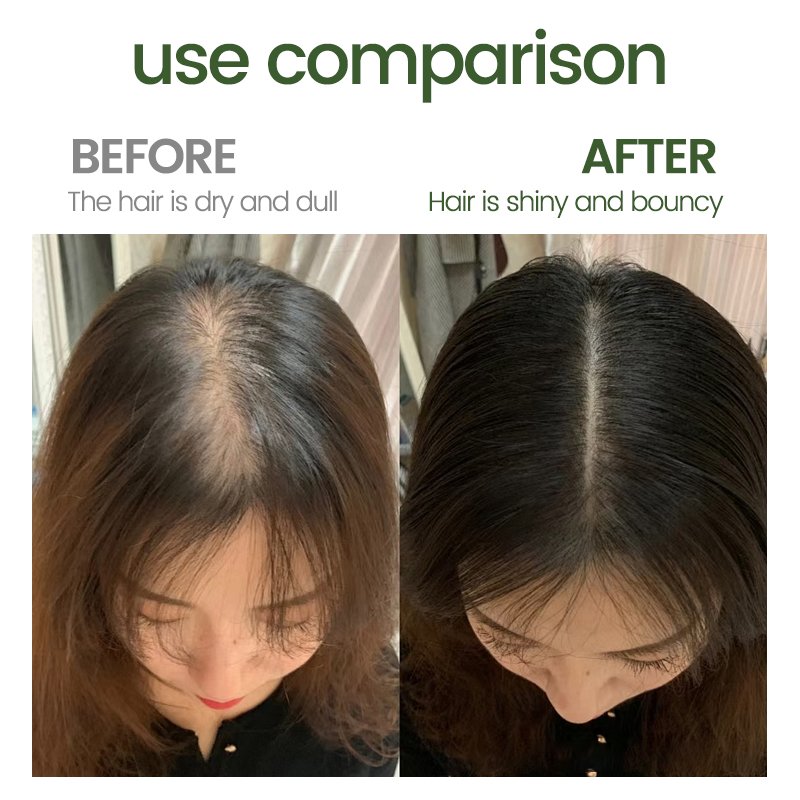 Jotigo Private Label Biotin Rosemary Essential Oil Promote Hair Growth Strengthen Scalp Repair Care Mint Hair Growth Oil