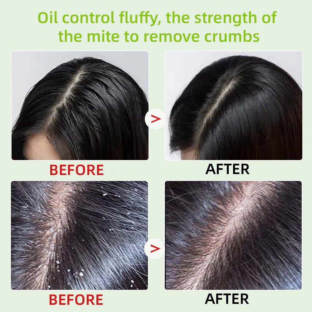 China Wholesale Customization Natural herbal aloe vera shampoo Oil Control Anti Dandruff Moisturizing shampoo
