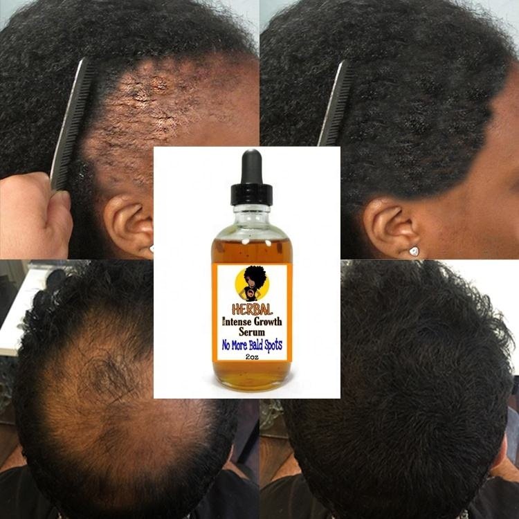 Private Label Black Seed Castor Oil Hair Growth Serum Growth Oil for Black Woman Hair Growth