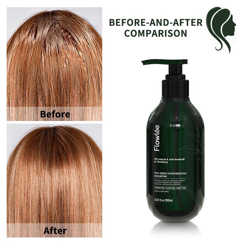 DIWEI 100% Pure Natural Custom Private Label Fast Hair Growth Ginger Anti-Dandruff Organic Tea Tree Oil Shampoo