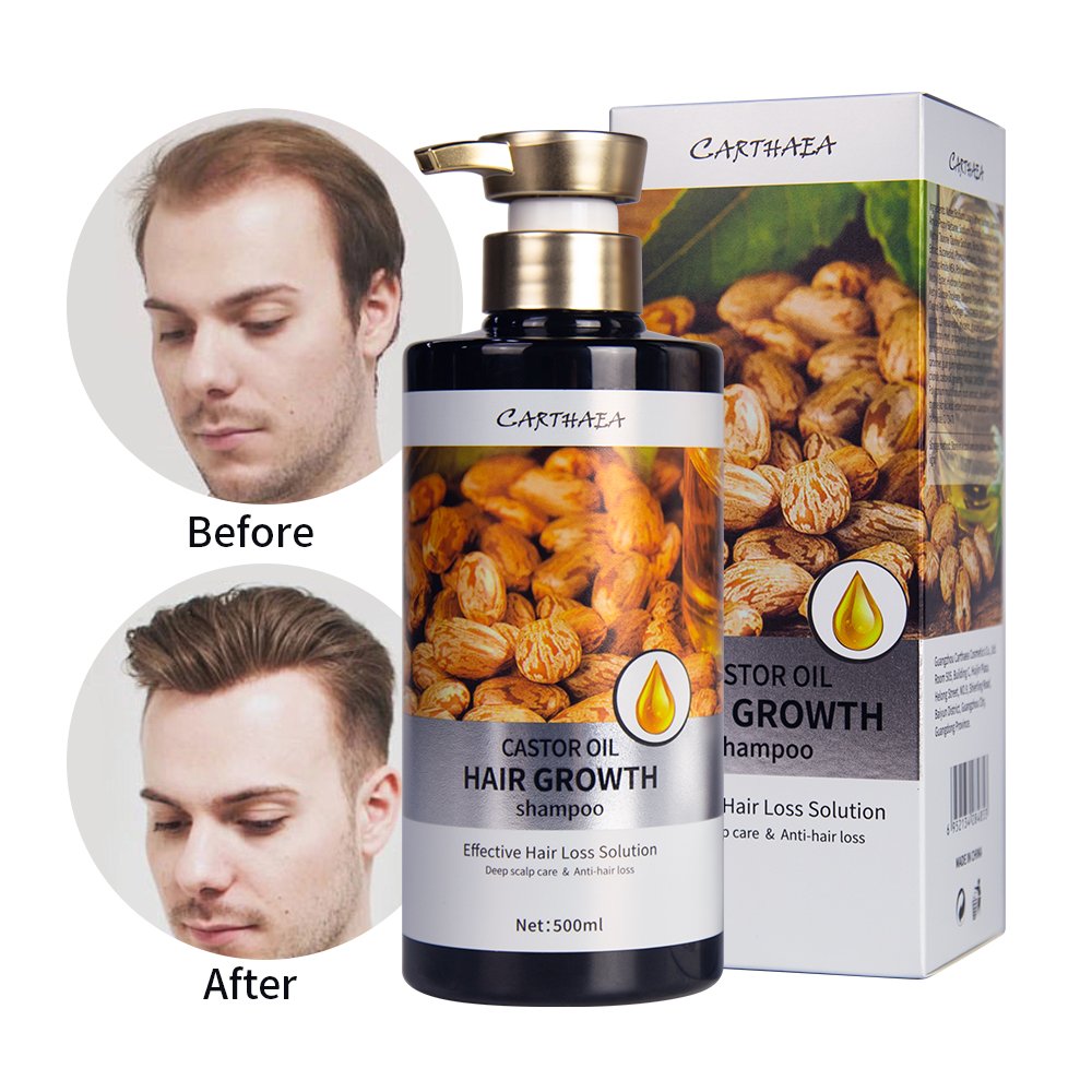 Private Label Shampoo and Conditioner Set Hair Growth Biotin anti-hair Loss Organic Ginger castor oil shampoo hair growth