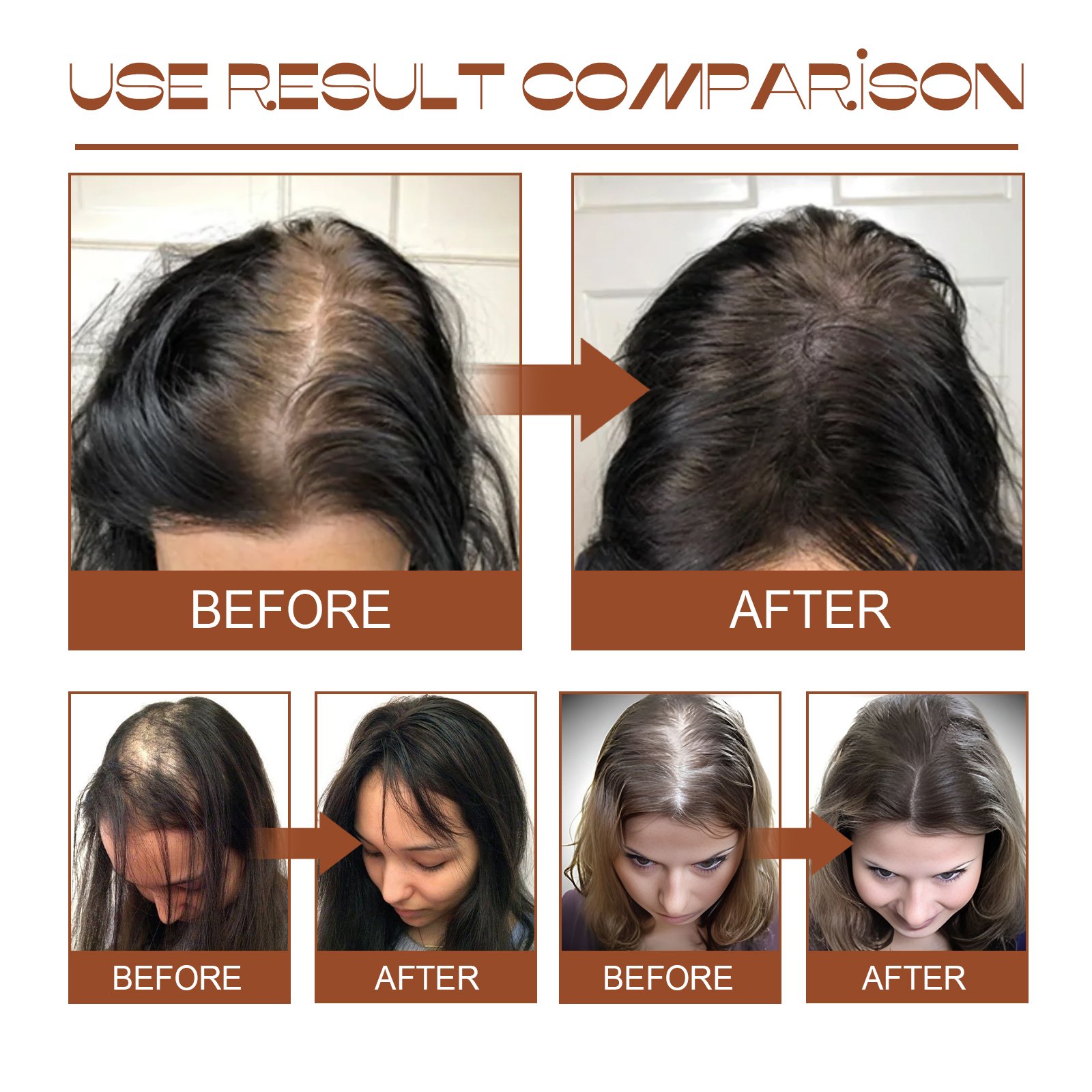 EELHOE Wholesale Moisturizing Strengthening Repair Hair Roots For Hair Growth 100% Unrefined Batana Oil Shampoo and Conditioner