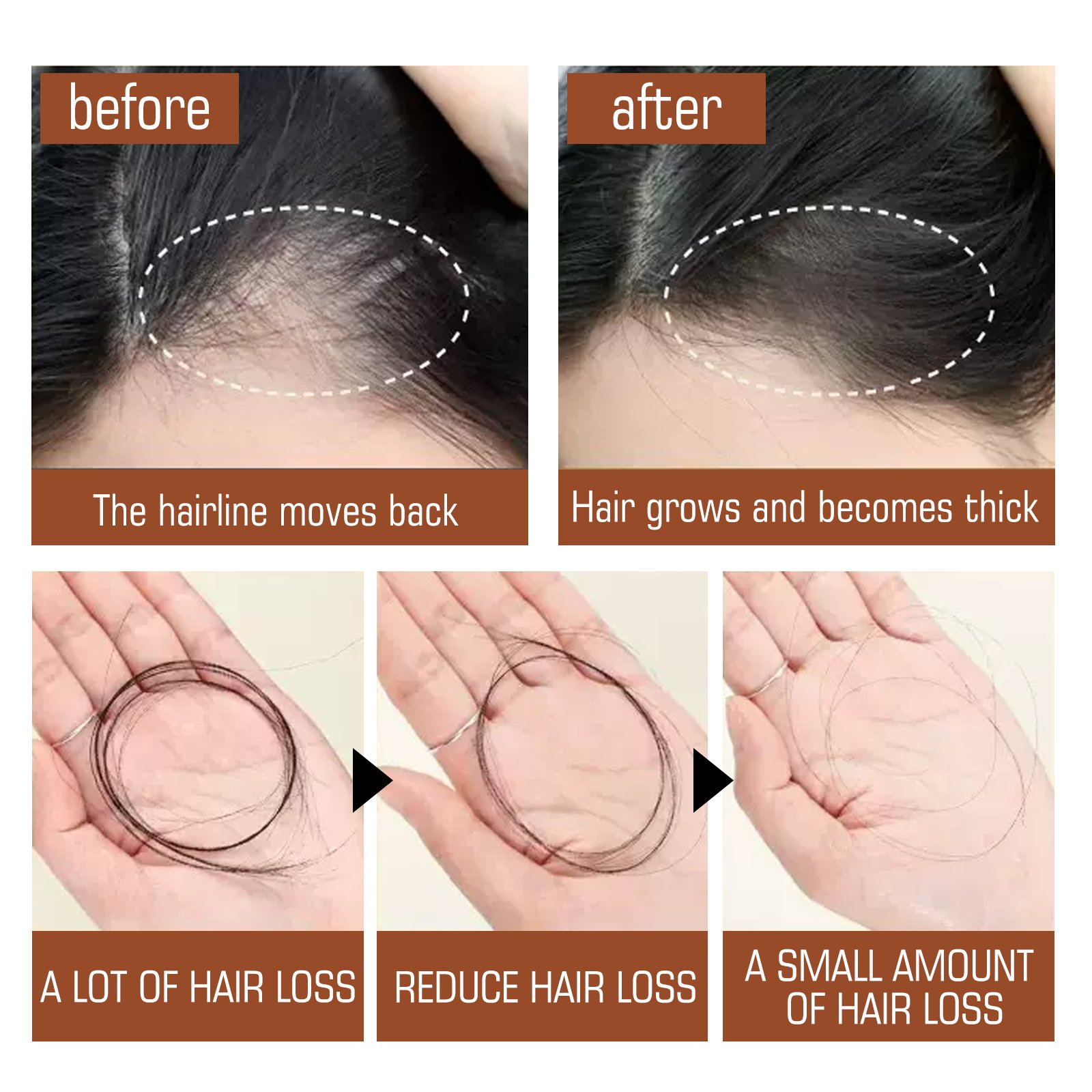 EELHOE Wholesale Moisturizing Strengthening Repair Hair Roots For Hair Growth 100% Unrefined Batana Oil Shampoo and Conditioner