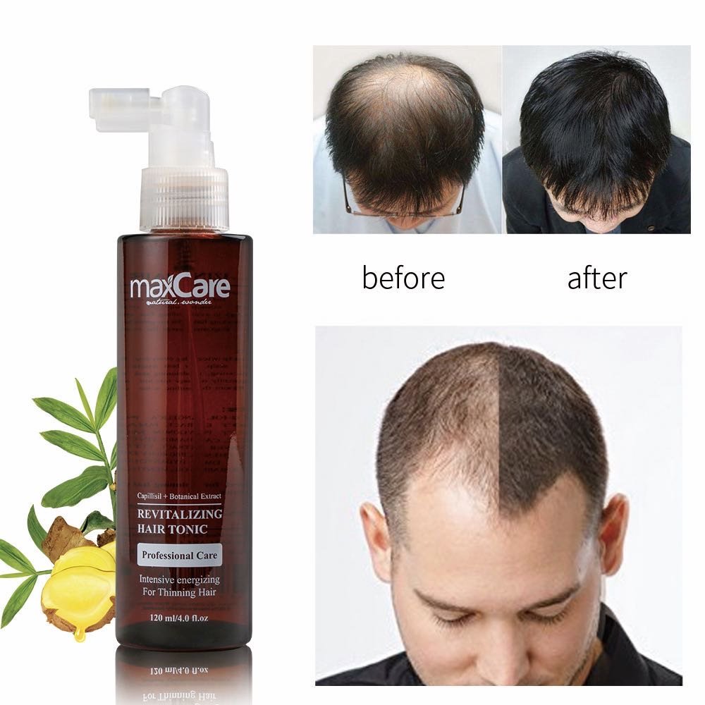 Herbal Ginger Hair Tonic Serum for Anti-Hair Loss Scalp Health Hair Regrowth