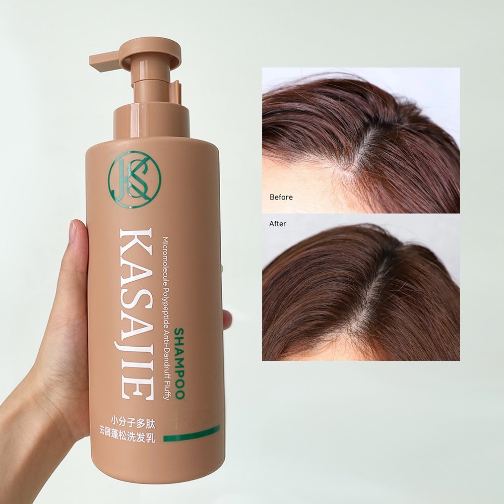 OEM ODM Factory Natural Hyaluronic Acid Dandruff Clarifying Itchy Relief Shampoo for Normal To Oily Hair