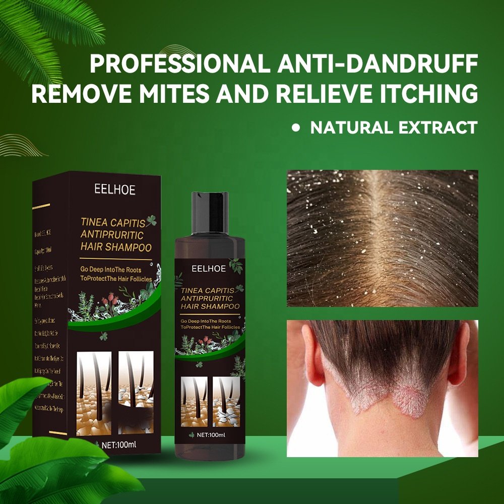 EELHOE 100% Natural Moisturizing Anti Itching Remove Tinea Capitis Mites Plant Extract Herbal Anti-Dandruff Shampoo