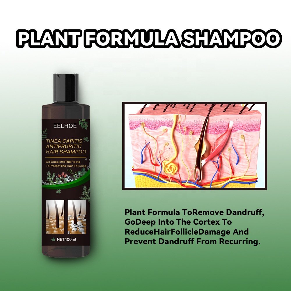 EELHOE 100% Natural Moisturizing Anti Itching Remove Tinea Capitis Mites Plant Extract Herbal Anti-Dandruff Shampoo