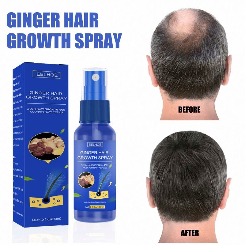 EELHOE Herbal Anti Loss Serum Essential Oil For Regrowth Hair Growth Ginger Spray