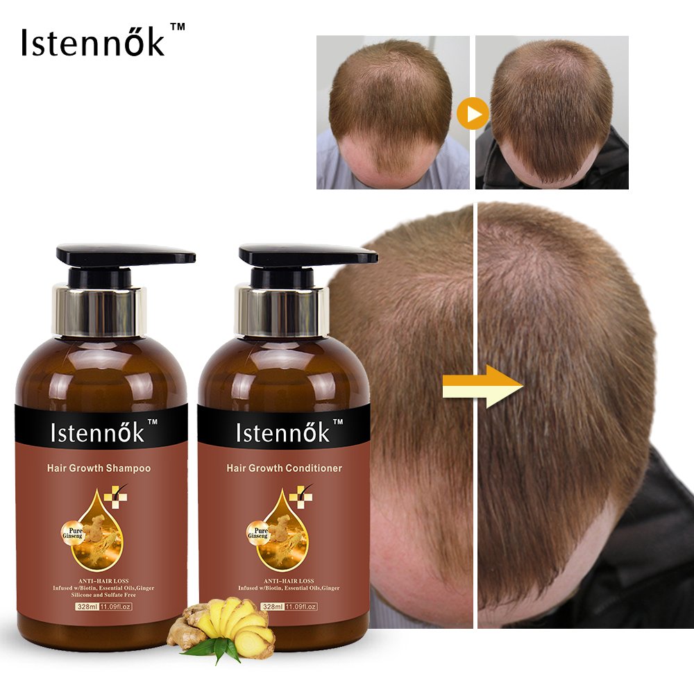 Biotin Shampoo Against Hair Loss Rosemary Thickening Shampoo Conditioner Private label