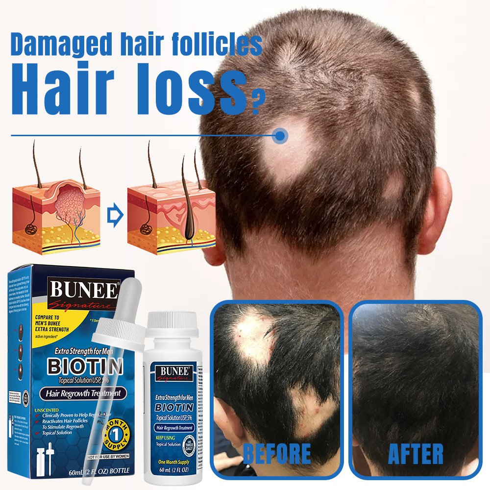 60ml Kirland Hair Growth Serum Oil Biotin 5% anti hair loss treatment Male Female Rogane Hair Regrowth Treatment Private Label