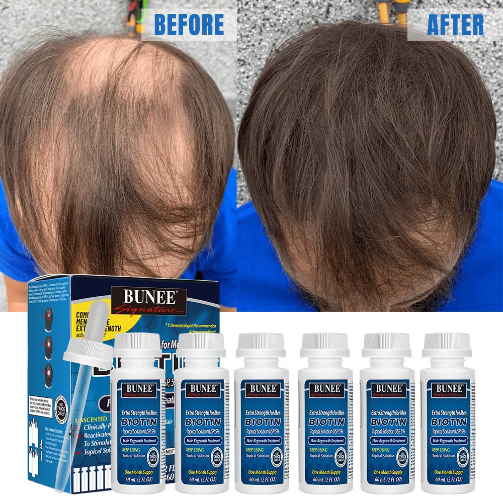 60ml Kirland Hair Growth Serum Oil Biotin 5% anti hair loss treatment Male Female Rogane Hair Regrowth Treatment Private Label
