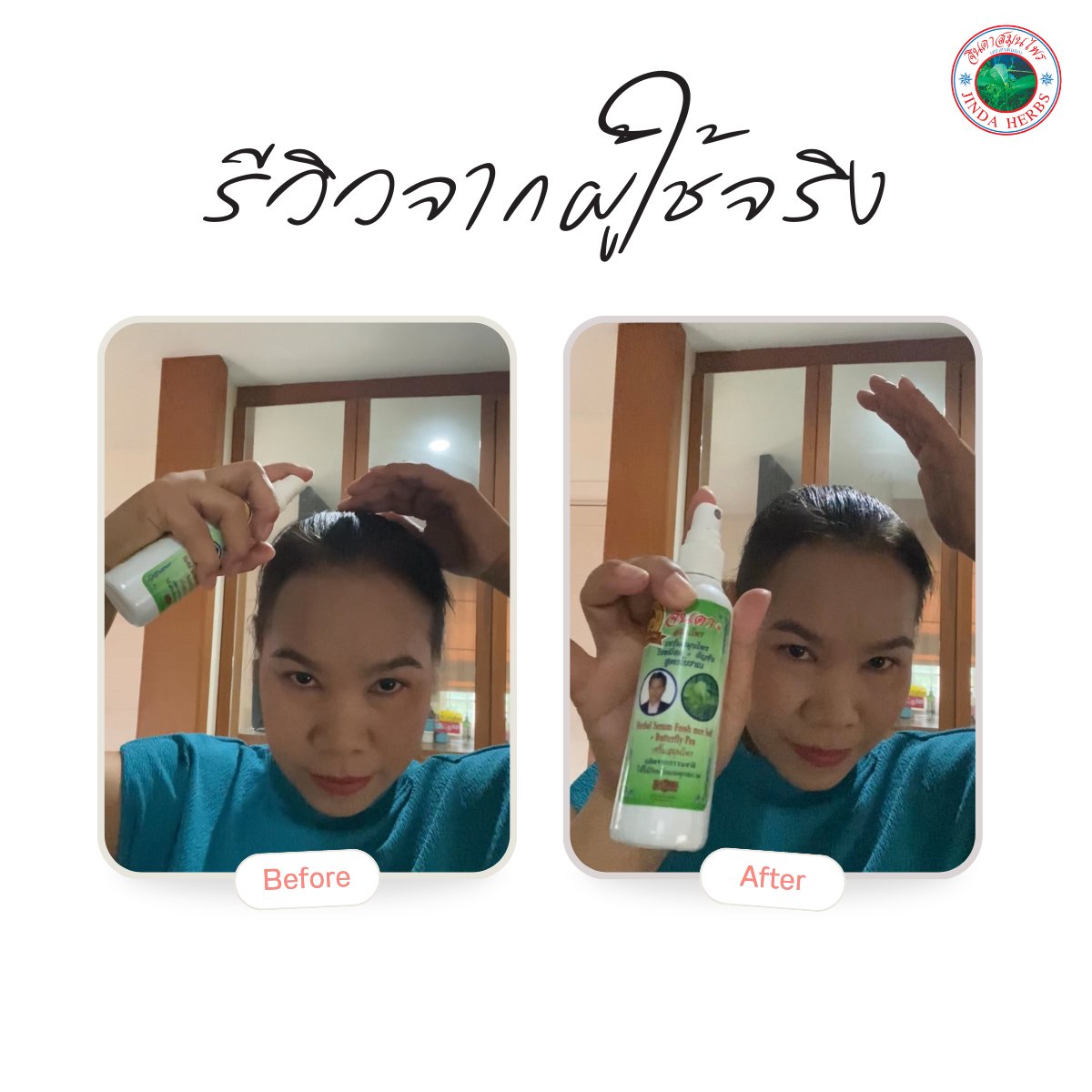 Hair Growth Portable Anthocyanin Herbal Serum Hair Regrowth Tonic for Baldness and Hair Loss Treatment Promotes