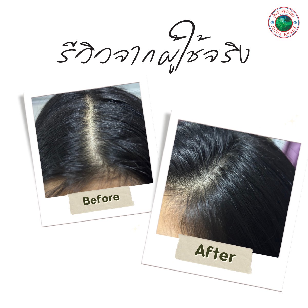 Hair Growth Portable Anthocyanin Herbal Serum Hair Regrowth Tonic for Baldness and Hair Loss Treatment Promotes