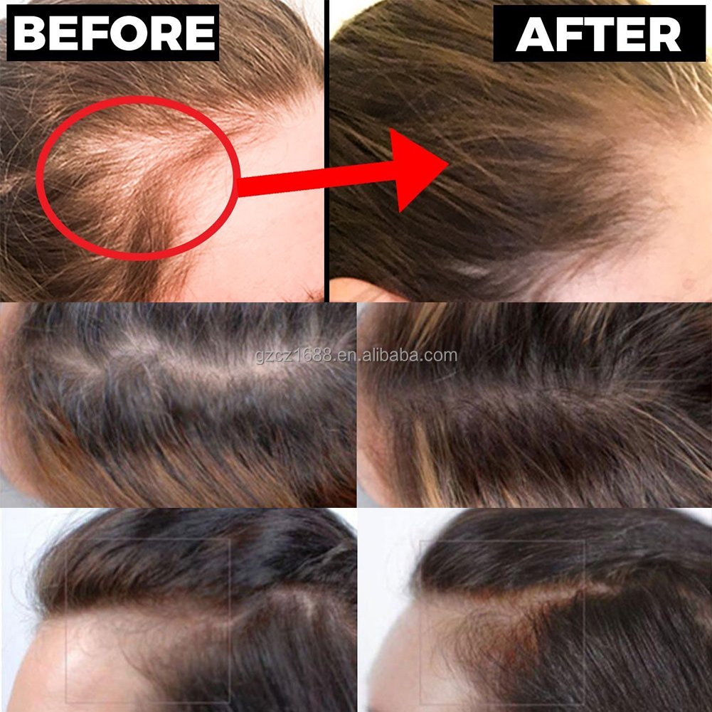 private label organic natural african black women with castor and biotin regrowth serum rosemary hair growth oil