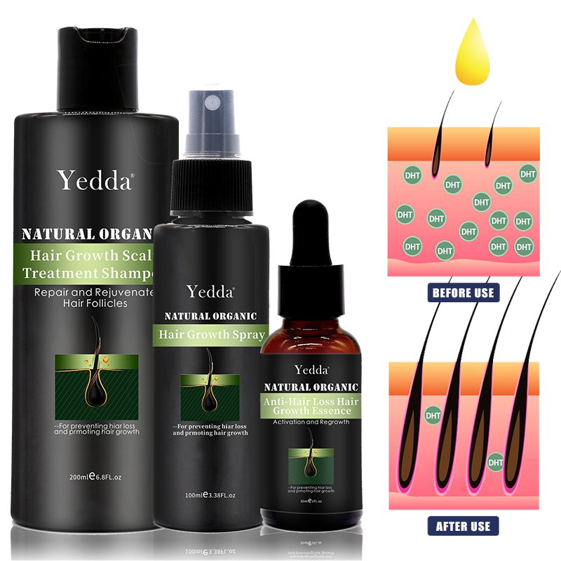 Hair Regrowth Essence Anti-Hair Loss Treatment Growth Oil Professional Fast Plant Extract Shampoo