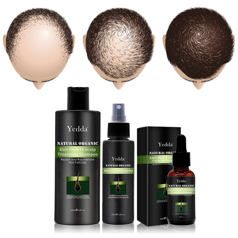 Hair Regrowth Essence Anti-Hair Loss Treatment Growth Oil Professional Fast Plant Extract Shampoo