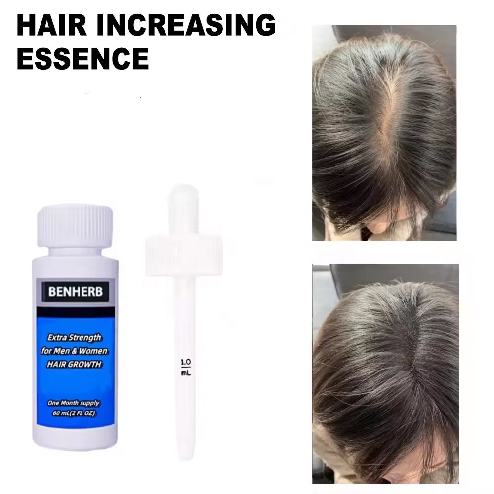 60ML 5% Hair Regrowth Oil Hair Care Loss Treatment Hair Growth Serum Kit for men
