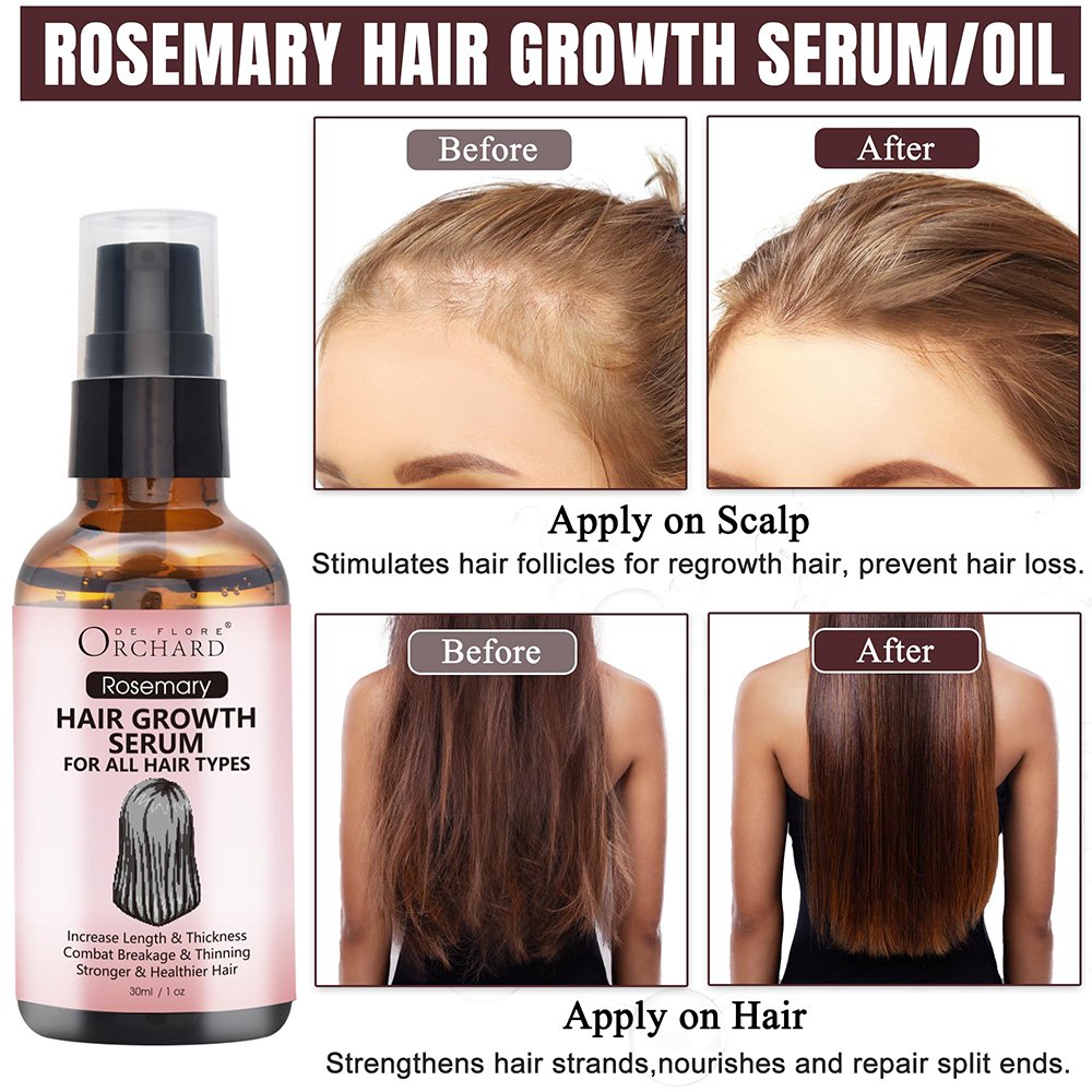 Hot Selling Hair Care Moisturizing And Repairing Ingrowth Rosemary Oil Hair Growth And Shampoo
