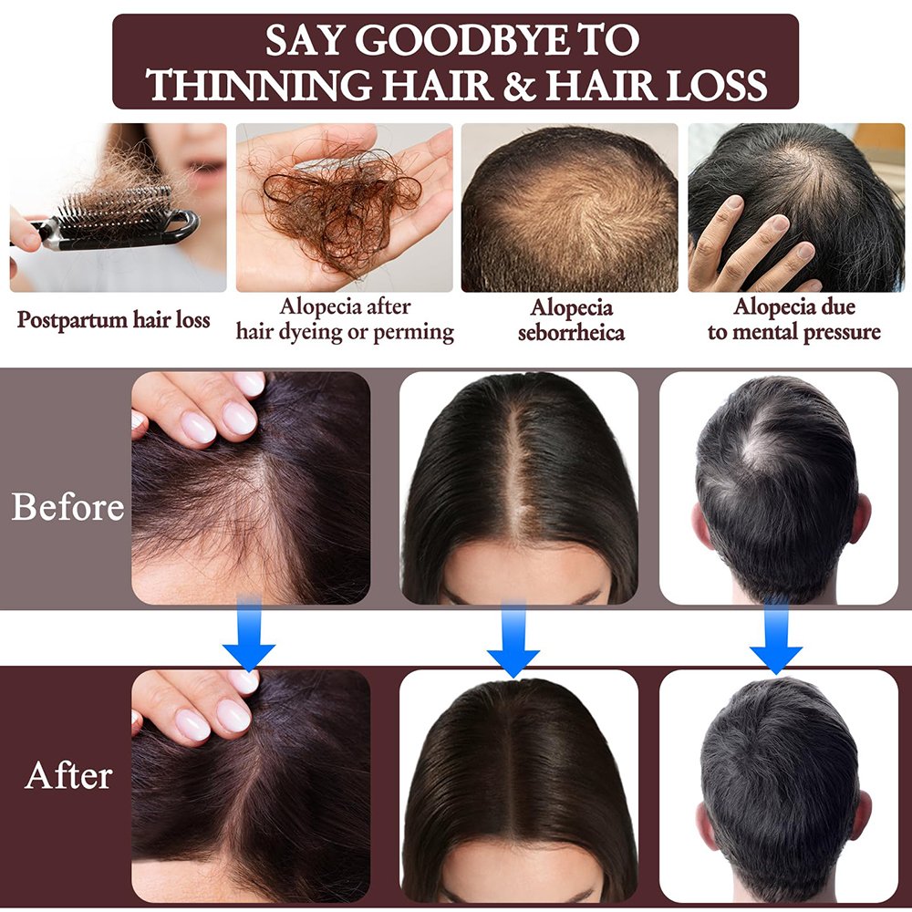 Hot Selling Hair Care Moisturizing And Repairing Ingrowth Rosemary Oil Hair Growth And Shampoo