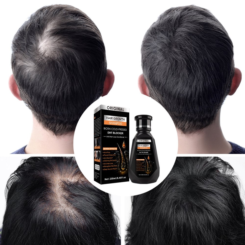 Private Label Hair Repairing Hair Growth Oil Control Natural Organic Hair Loss Care Ginger Shampoo