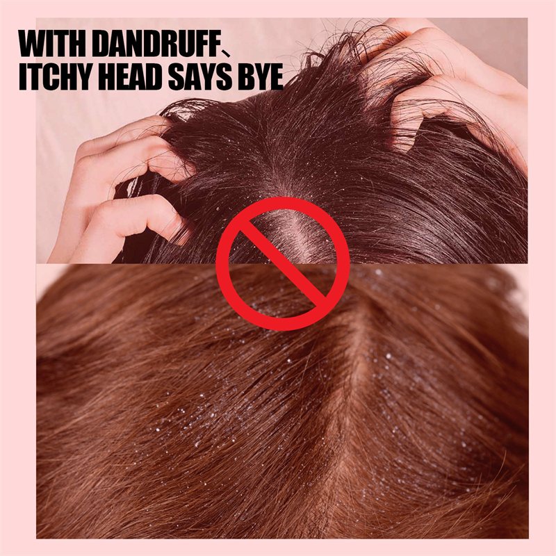 South Moon sulfur hair dandruff shampoo refreshing itch relieving tinea capitis reducing best hair seborrheic scalp shampoo