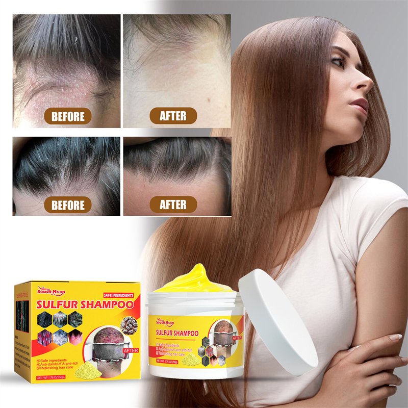 South Moon sulfur hair dandruff shampoo refreshing itch relieving tinea capitis reducing best hair seborrheic scalp shampoo