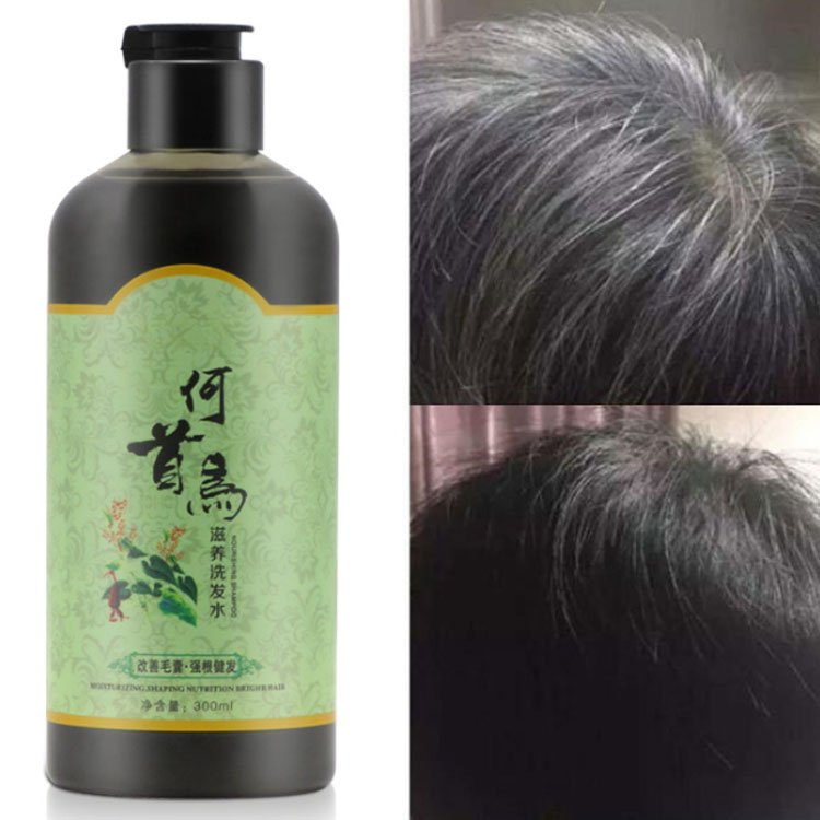 Wholesale Organic anti hair loss shampoo polygonum multiflorum shampoo