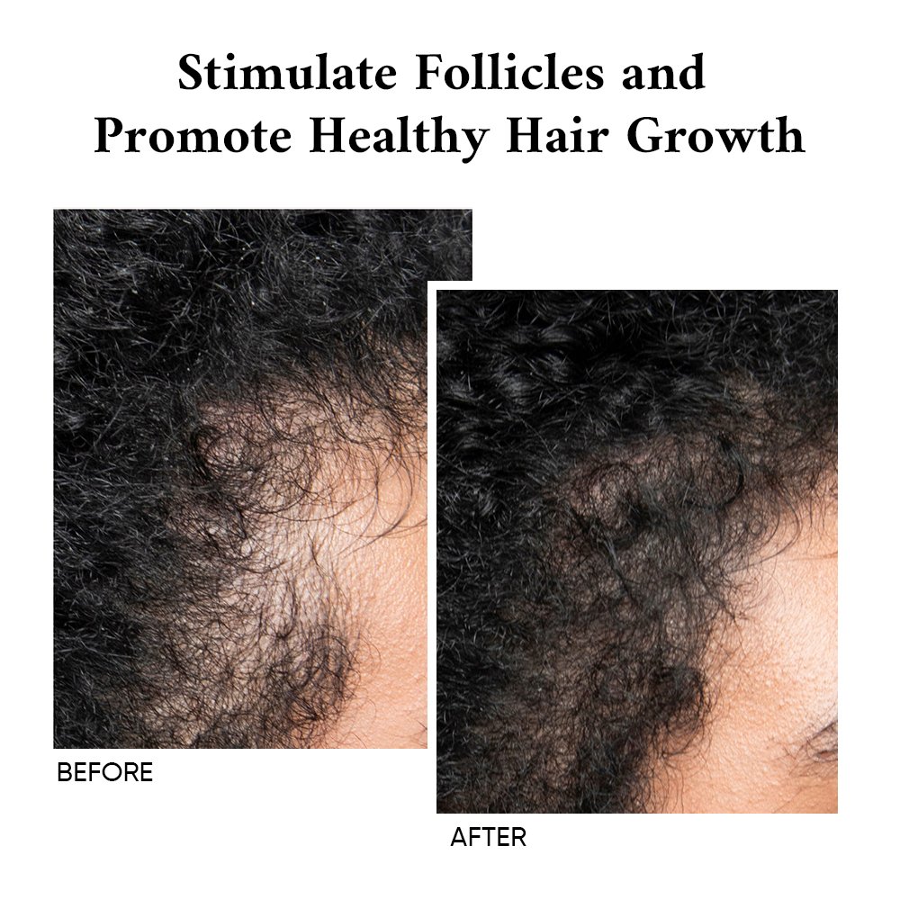 Custom Logo Dry Scalp Treatment Strengthening Reduce Hair Fall Leave-In Thickening Hair Grooming Tonic Men For Hair Loss