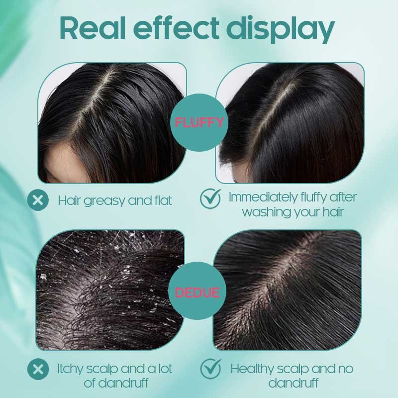 Jotigo Hair Care Infinite Anti Dandruff Hair Organic Tea Tree Oil Lavender Mint Shampoo
