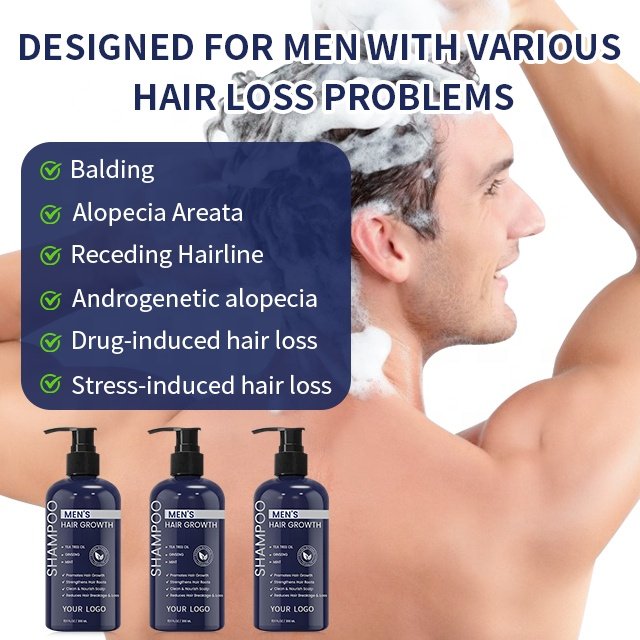 Shampoo Supplier Wholesale Herbal Anti Hair Loss Shampoo China Hair Product For Hair Growth Mens Shampoo