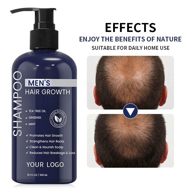 Shampoo Supplier Wholesale Herbal Anti Hair Loss Shampoo China Hair Product For Hair Growth Mens Shampoo